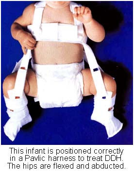 infant in pelvic harness