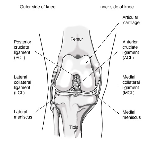 knee implant 2