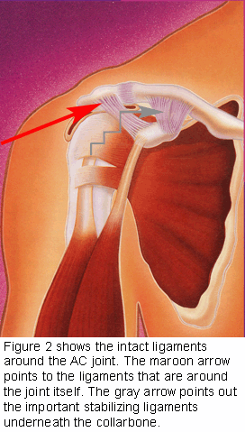 mechanism of injury