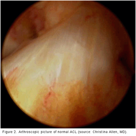 figure 2 normal ACL