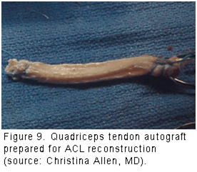 figure 9 quadriceps tendon