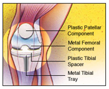 knee diagram 3