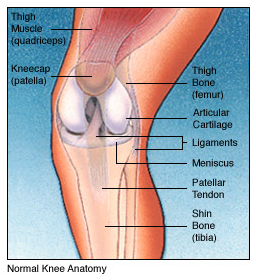 knee replacement diagram 2